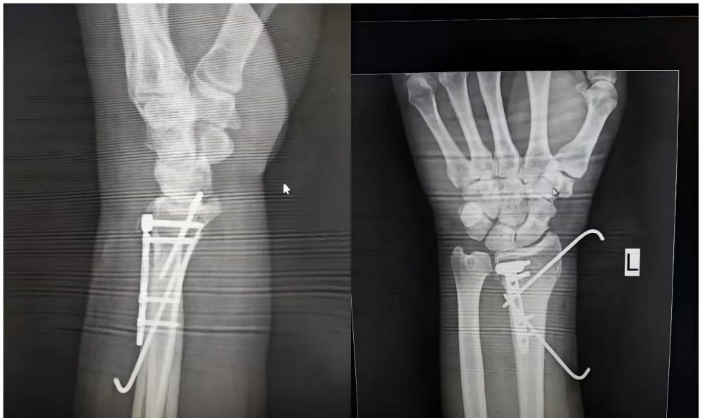 1730426489826253.jpg e7f50947a8ee77c0f0067e7aeb2aa30.jpg